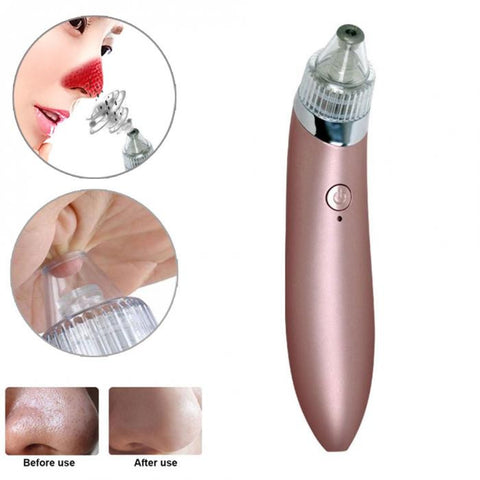 Cleaner Acne Remover Wrinkle Remover Vacuum Lift System Beauty Machine